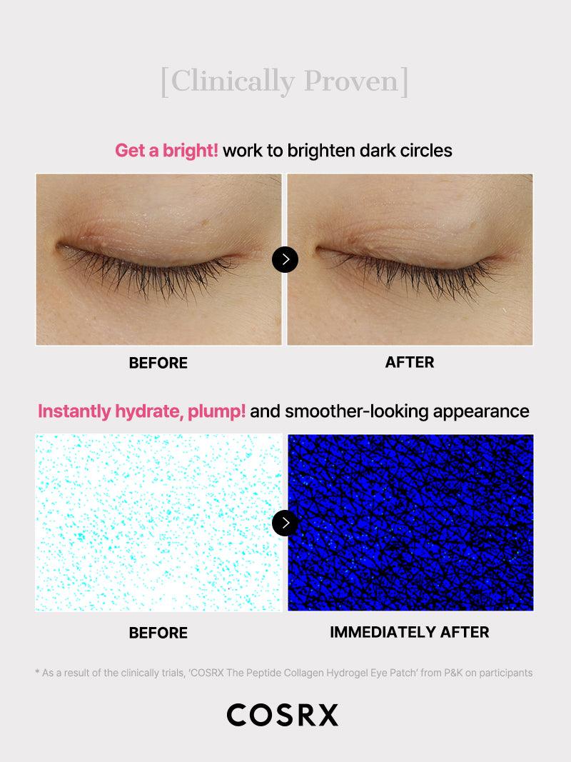 Peptide Collagen Under-Eye Hydrogel Patches