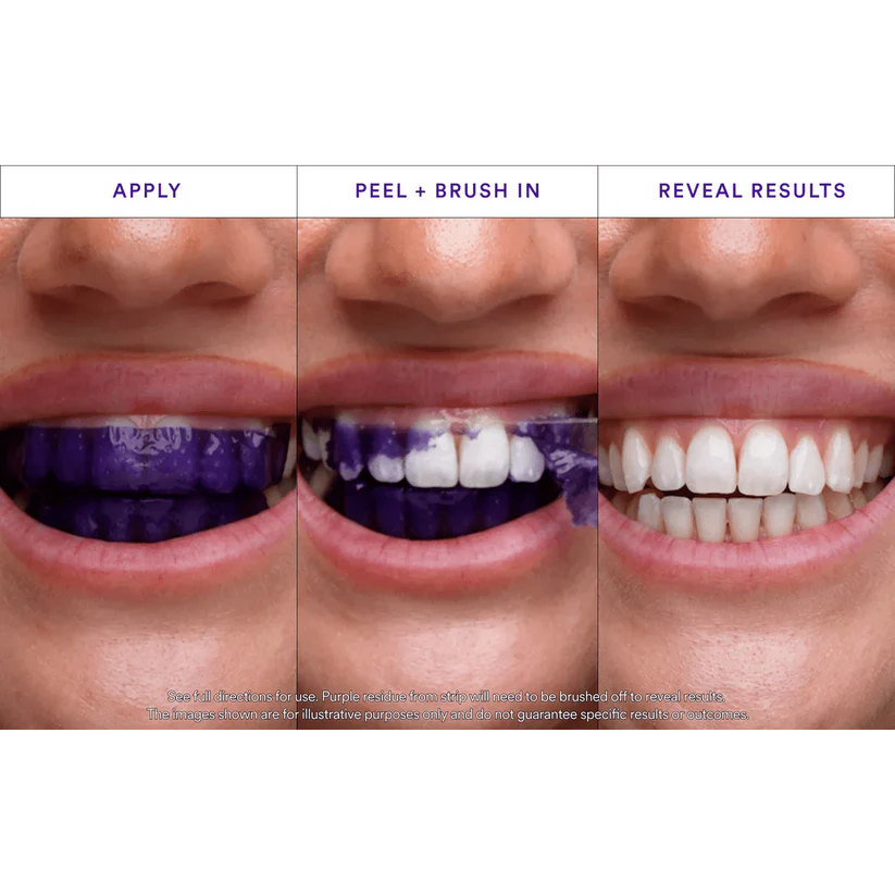 Purple Whitening Strips