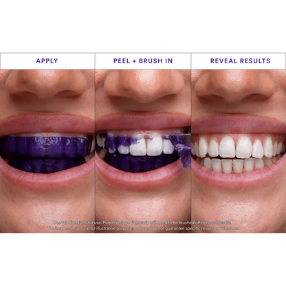 Purple Whitening Strips